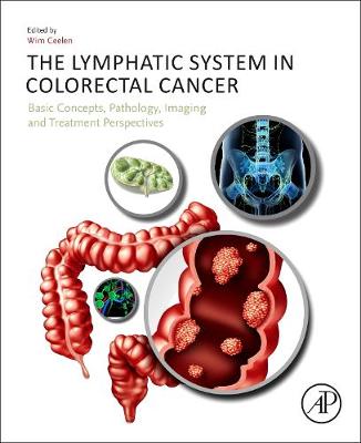 The Lymphatic System in Colorectal Cancer