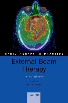 External Beam Therapy