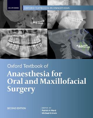 Oxford Textbook of Anaesthesia for Oral and Maxillofacial Surgery, Second Edition