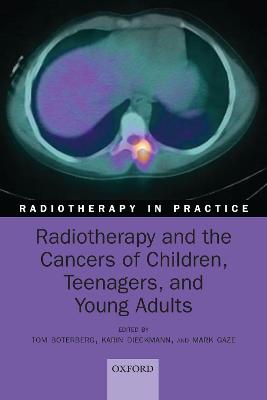 Radiotherapy and the Cancers of Children, Teenagers, and Young Adults