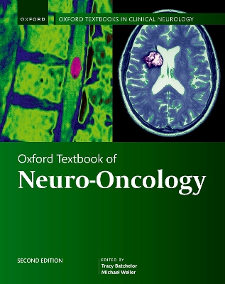 Oxford Textbook of Neuro-Oncology