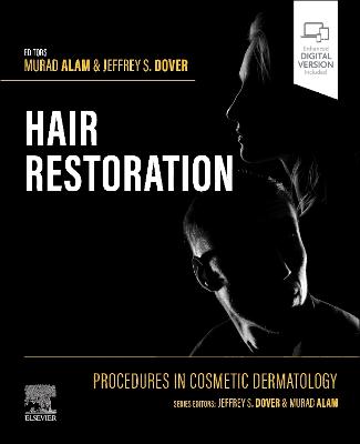 Procedures in Cosmetic Dermatology: Hair Restoration