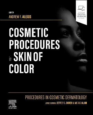 Procedures in Cosmetic Dermatology: Cosmetic Procedures in Skin of Color