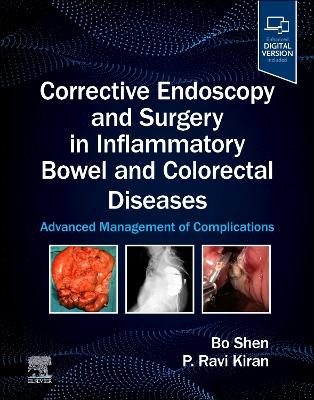 Corrective Endoscopy and Surgery in Inflammatory Bowel and Colorectal Diseases