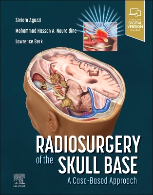 Radiosurgery of the Skull Base: A Case-Based Approach