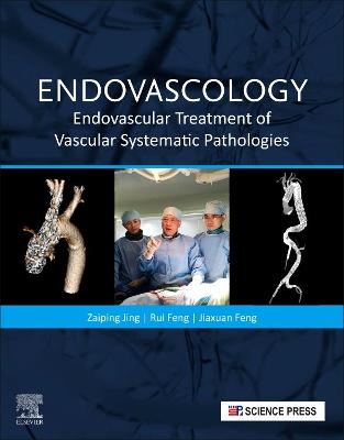 Endovascology
