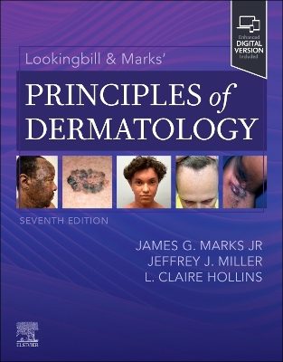 Lookingbill & Marks' Principles of Dermatology