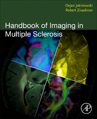 Handbook of Imaging in Multiple Sclerosis