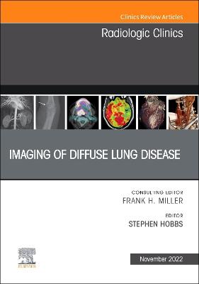 Imaging of Diffuse Lung Disease, An Issue of Radiologic Clinics of North America