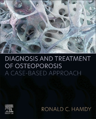 Diagnosis and Treatment of Osteoporosis