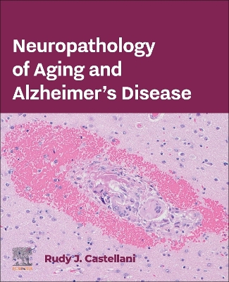 Neuropathology of Aging and Alzheimer's Disease