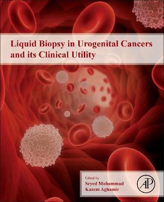 Liquid Biopsy in Urogenital Cancers and their Clinical Utility