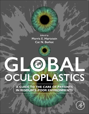 Global Oculoplastics