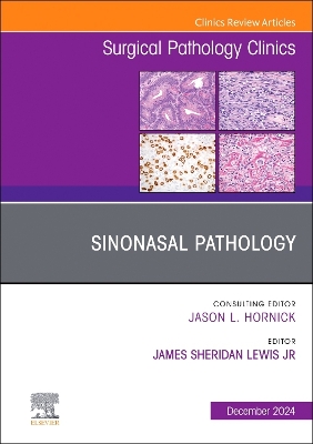 Sinonasal Pathology, An Issue of Surgical Pathology Clinics