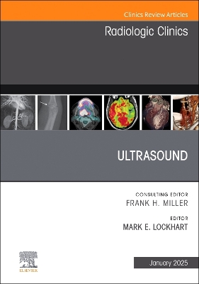 Ultrasound, An Issue of Radiologic Clinics of North America