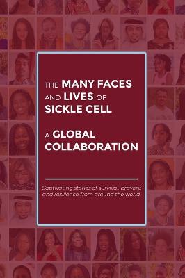 Many Faces and Lives of Sickle Cell - A Global Collaboration