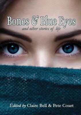 Bones and Blue Eyes and other Stories of Life