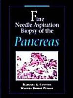 Fine Needle Aspiration Biopsy of the Pancreas