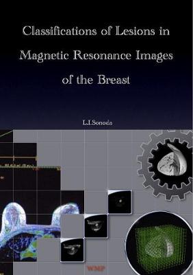 Classifications of Lesions in Magnetic Resonance Images of the Breast