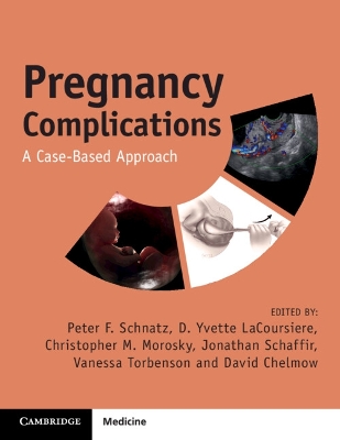 Pregnancy Complications