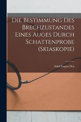 Bestimmung Des Brechzustandes Eines Auges Durch Schattenprobe (Skiaskopie)