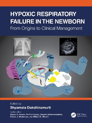 Hypoxic Respiratory Failure in the Newborn