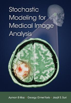 Stochastic Modeling for Medical Image Analysis
