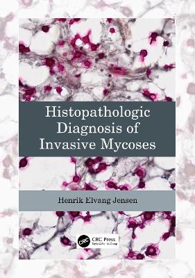 Histopathologic Diagnosis of Invasive Mycoses