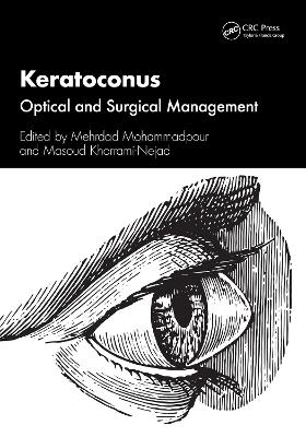 Keratoconus