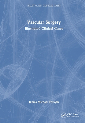 Vascular Surgery: