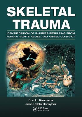 Skeletal Trauma