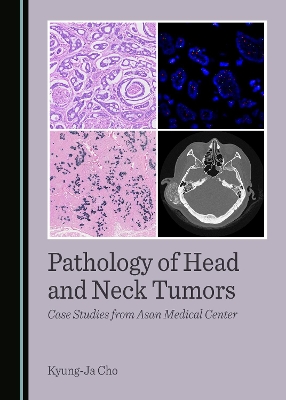 Pathology of Head and Neck Tumors