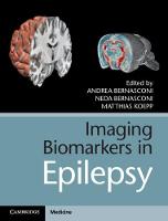 Imaging Biomarkers in Epilepsy