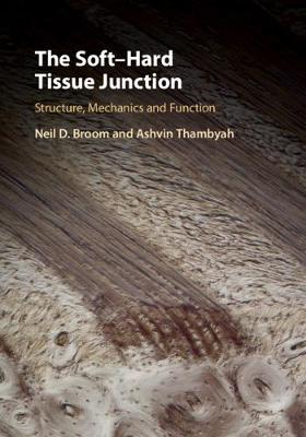 The Soft-Hard Tissue Junction