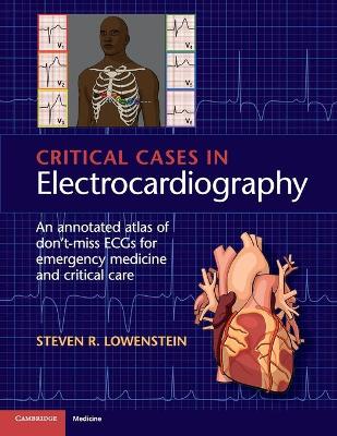 Critical Cases in Electrocardiography
