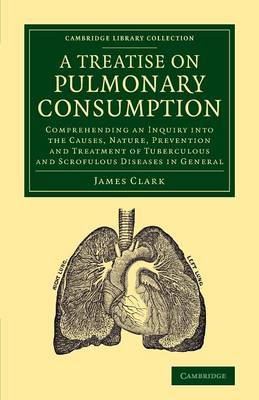 Treatise on Pulmonary Consumption