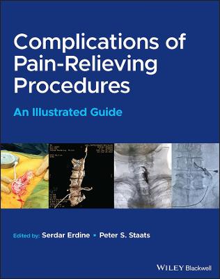 Complications of Pain-Relieving Procedures