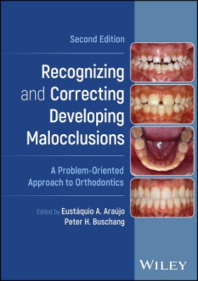 Recognizing and Correcting Developing Malocclusions