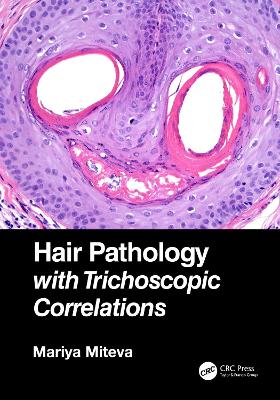 Hair Pathology with Trichoscopic Correlations