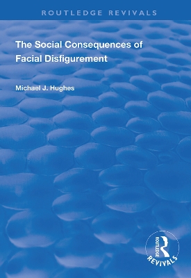Social Consequences of Facial Disfigurement