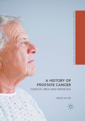 History of Prostate Cancer