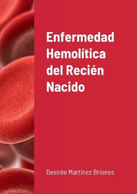 Enfermedad hemolitica del Recien Nacido