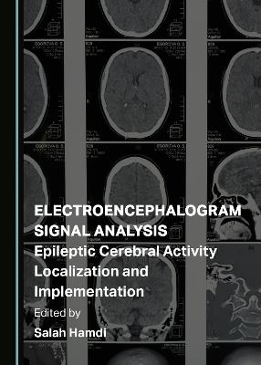 Electroencephalogram Signal Analysis