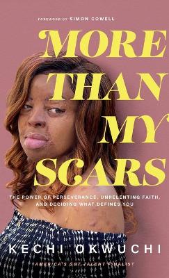 More Than My Scars