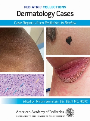 Dermatology Cases