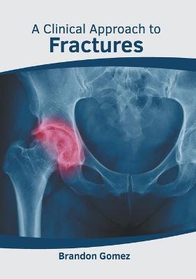 Clinical Approach to Fractures
