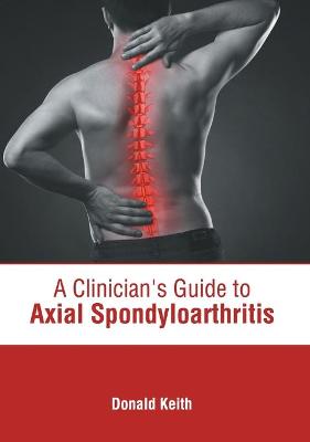 Clinician's Guide to Axial Spondyloarthritis