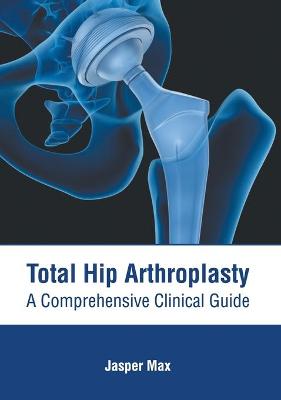 Total Hip Arthroplasty: A Comprehensive Clinical Guide