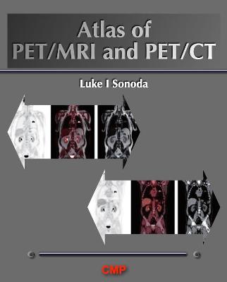 Atlas of PET/MRI and PET/CT