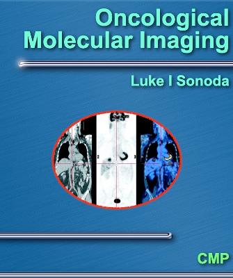 Oncological Molecular Imaging